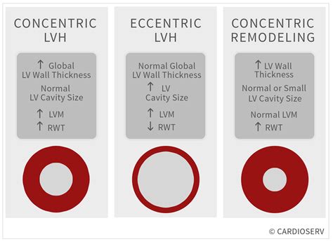 mild lv hypertrophy|eccentric vs concentric lv hypertrophy.